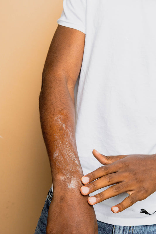 Eczema Relief Extra Strength Lotion: Gentle Hydration for All Ages